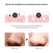Load image into Gallery viewer, Comedone Facial Vacuum Pro™  Instant Glow